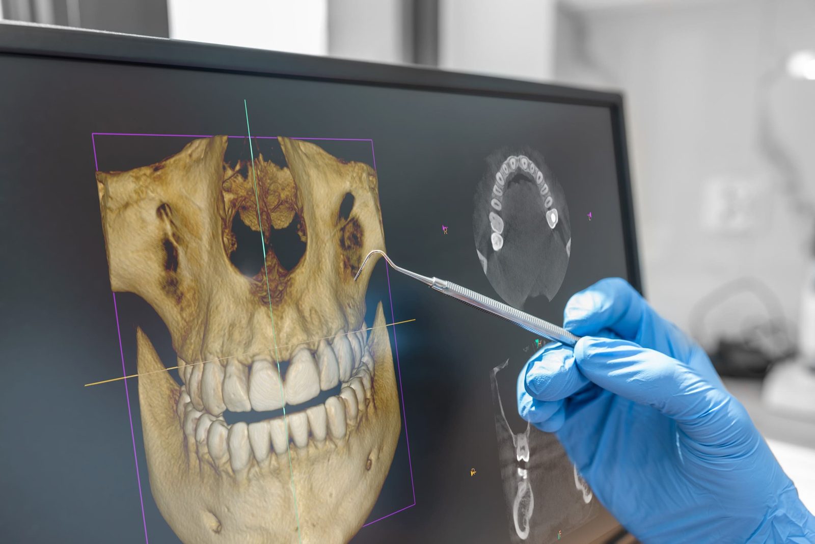 A 3D CBCT reconstruction reviewed on screen